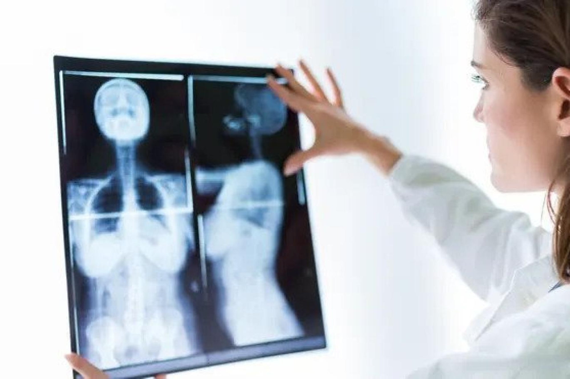 الذكاء الاصطناعي يدخل عالم السرطان