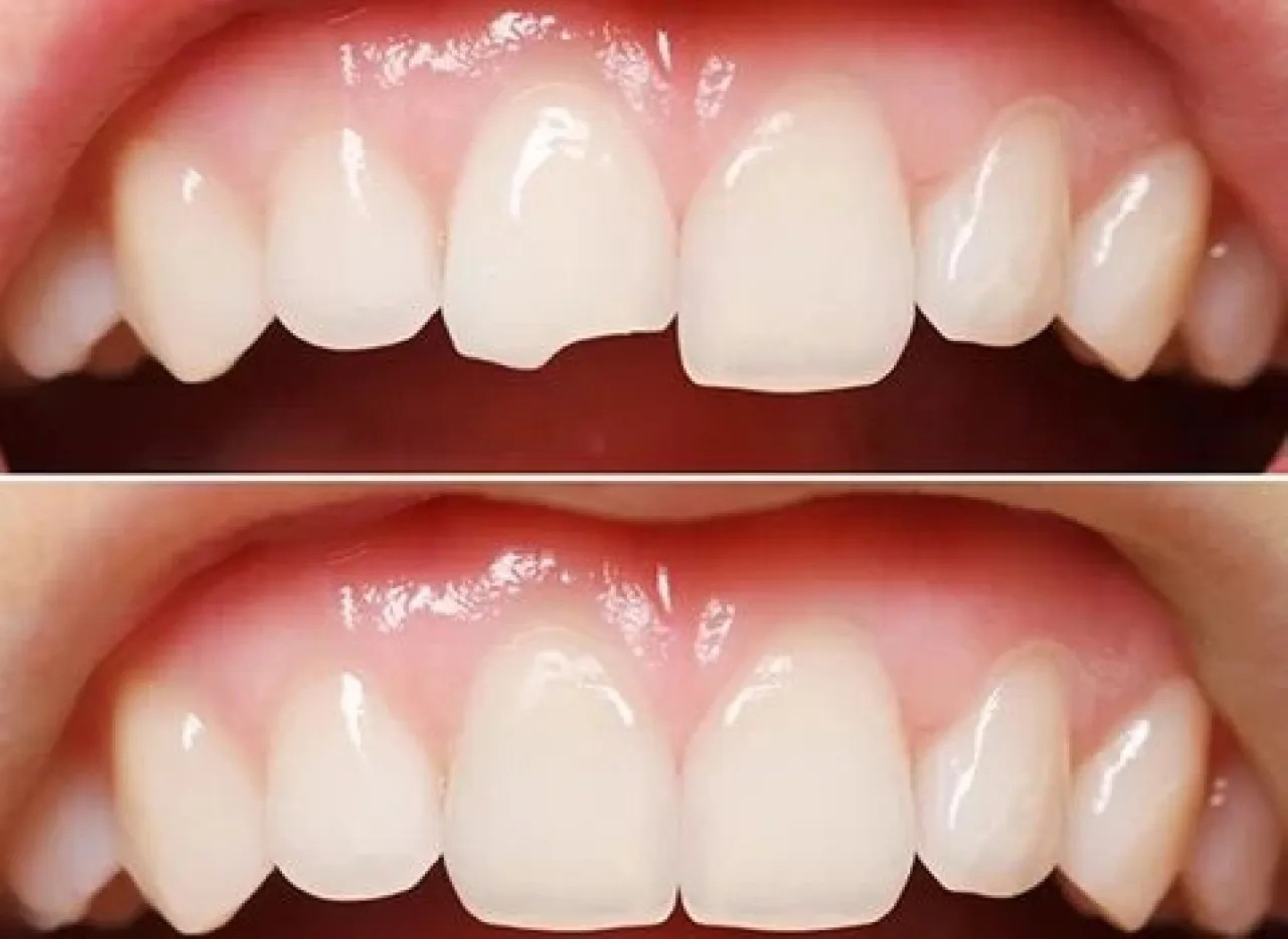 تغيّر مواعيد الطعام والنوم في رمضان ينعكس مباشرة على صحة الفم والأسنان